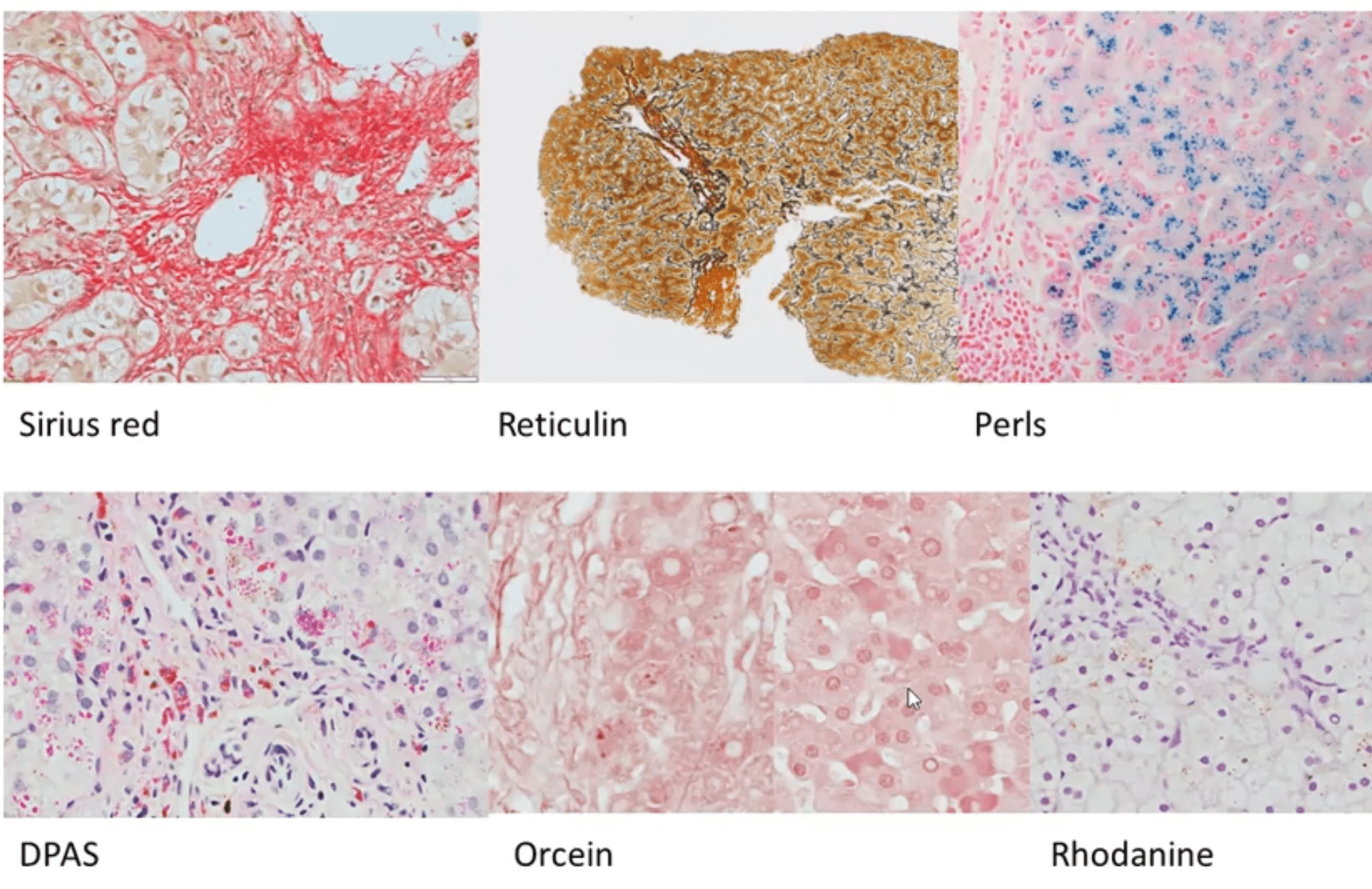 Introduction to Liver Histology- Maesha Deheragoda