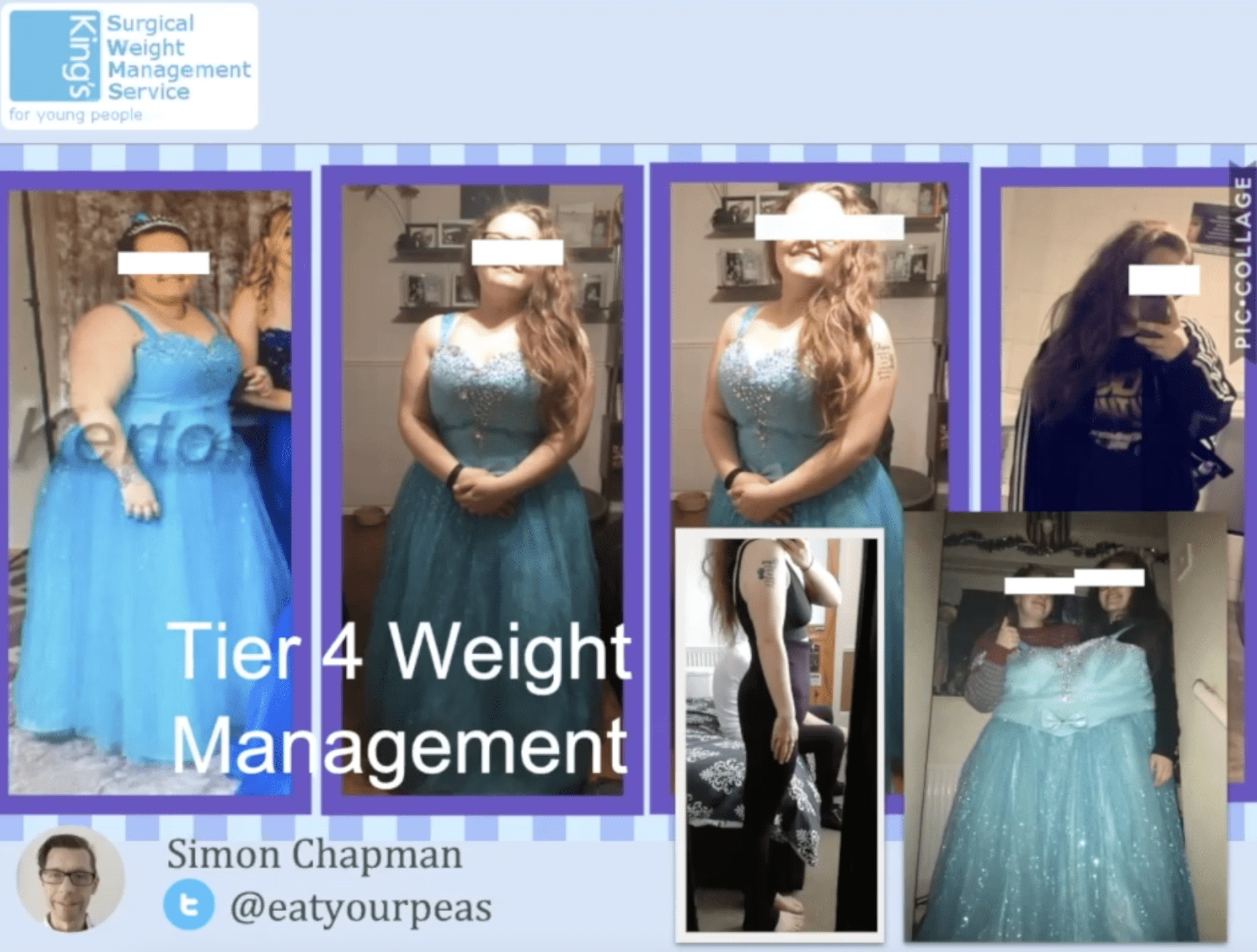 Obesity and Bariatric Surgery – Dr Simon Chapman