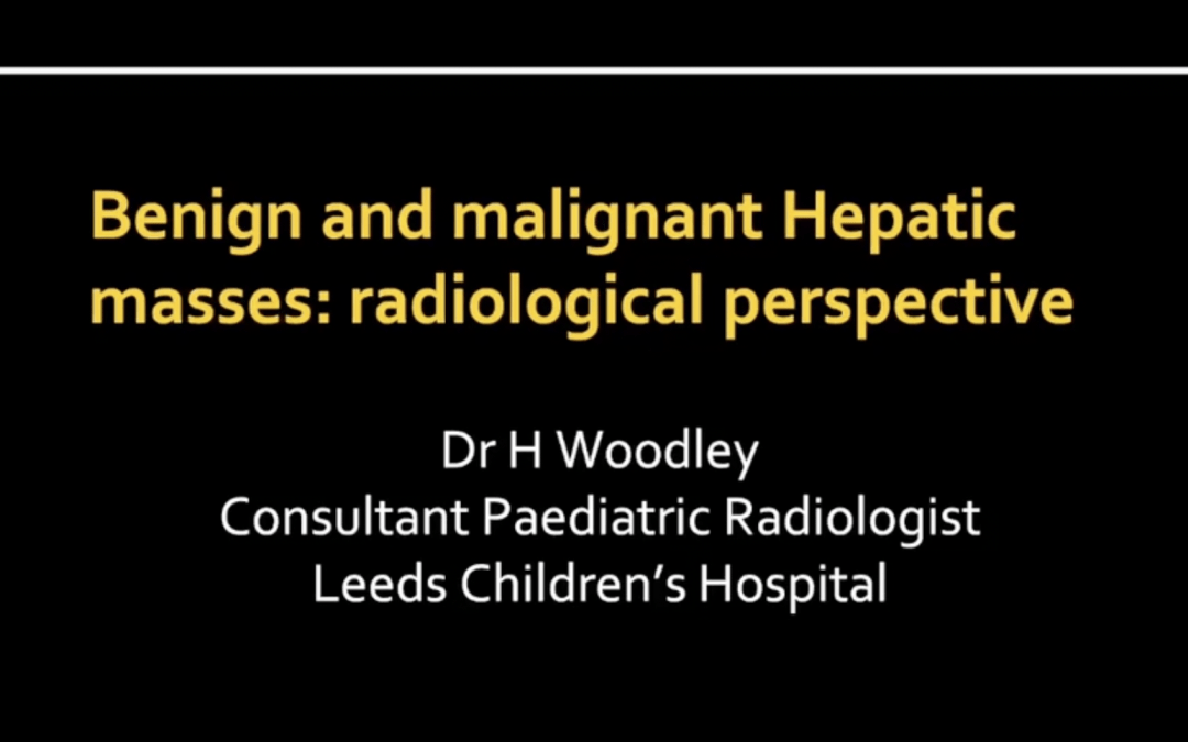 Imaging Paediatric Liver Masses – Dr Helen Woodley